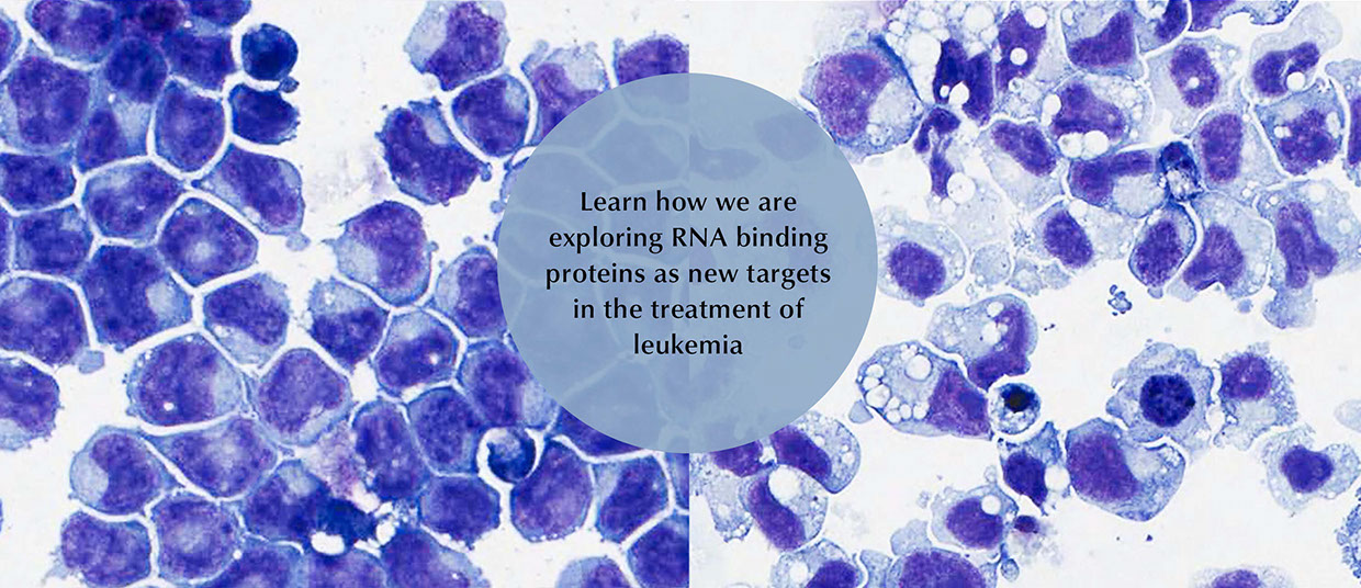 Hope Lab, research, leukemia, cells